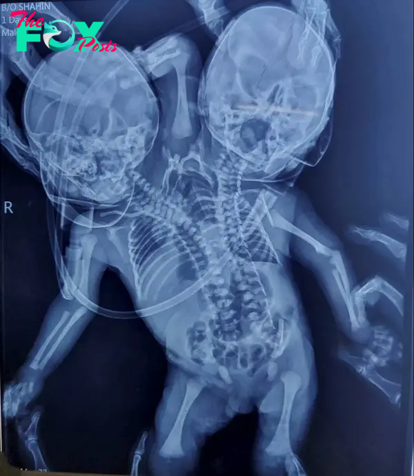 The x-ray of the baby has left doctors startled