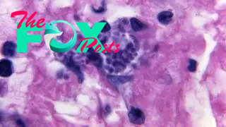 A view of a tissue sample that shows a Toxoplasma gondii cyst, the parasite that causes toxoplasmosis.