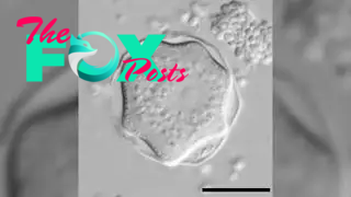 A photo of Acanthamoeba, the amoeba that causes a parasitic infection called keratitis.