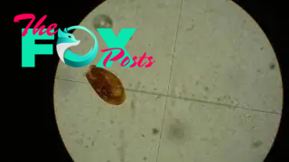 A microscopic view of the flatworm that causes paragonimus infection.