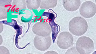 A photo of Trypanosoma brucei gambiense, the parasite that causes sleeping sickness or human African trypanosomiasis.