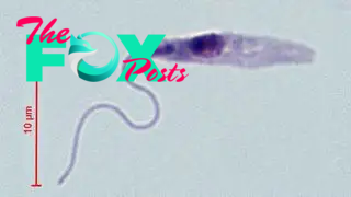 A photo of Trypanosoma brucei gambiense, a type of parasite that causes the infection leishmaniasis.