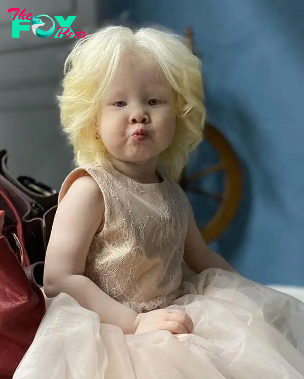 2 albino sisters in Kazakhstan are famous for their unique beauty-9