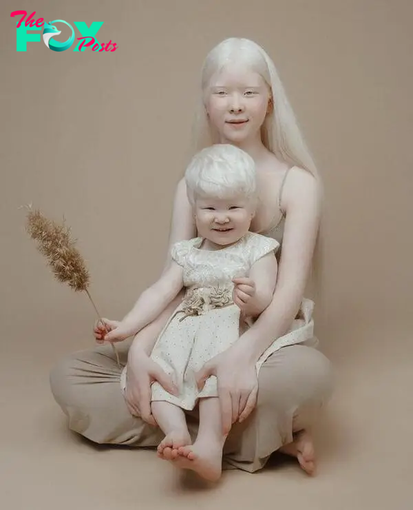 2 albino sisters in Kazakhstan are famous for their unique beauty-2