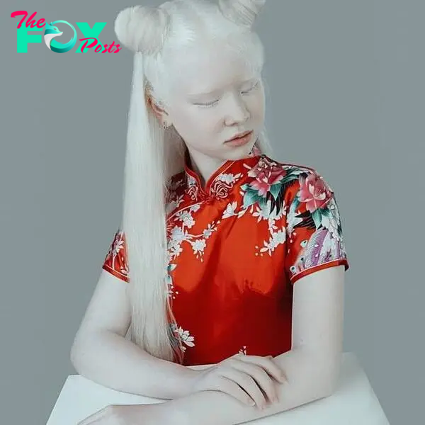 2 albino sisters in Kazakhstan are famous for their unique beauty-5