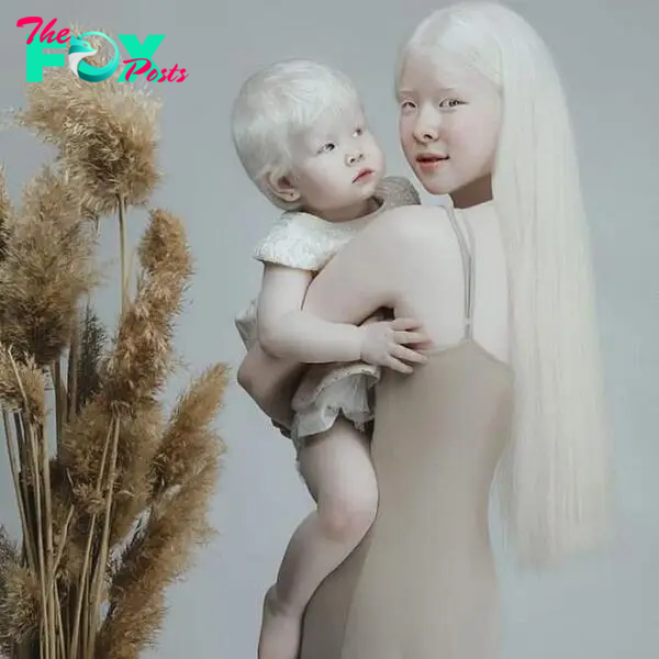 2 albino sisters in Kazakhstan are famous for their unique beauty-1