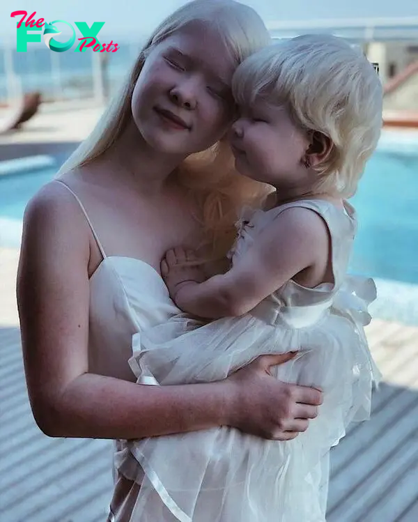 2 albino sisters in Kazakhstan are famous for their unique beauty-4