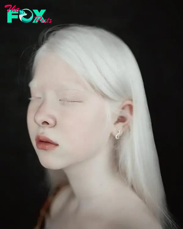 2 albino sisters in Kazakhstan are famous for their unique beauty-6