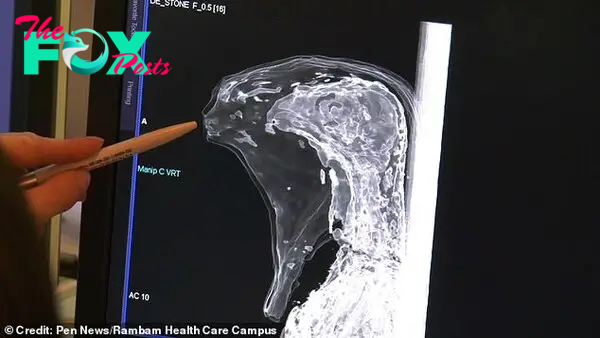 HAIFA, ISRAEL Photo shows a second bird-like mummy. A mysterious child-like mummy has been unmasked as the ancient Egyptian god of the dead after a CT scan revealed the remains aren't human (Credit: Pen News/Rambam Health Care Campus) (Pen News Â£25, Â£15, Â£10 online) (Contact editor@pennews.co.uk/07595759112)