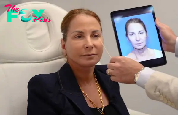 jill zarin next to an ipad of her face before surgery