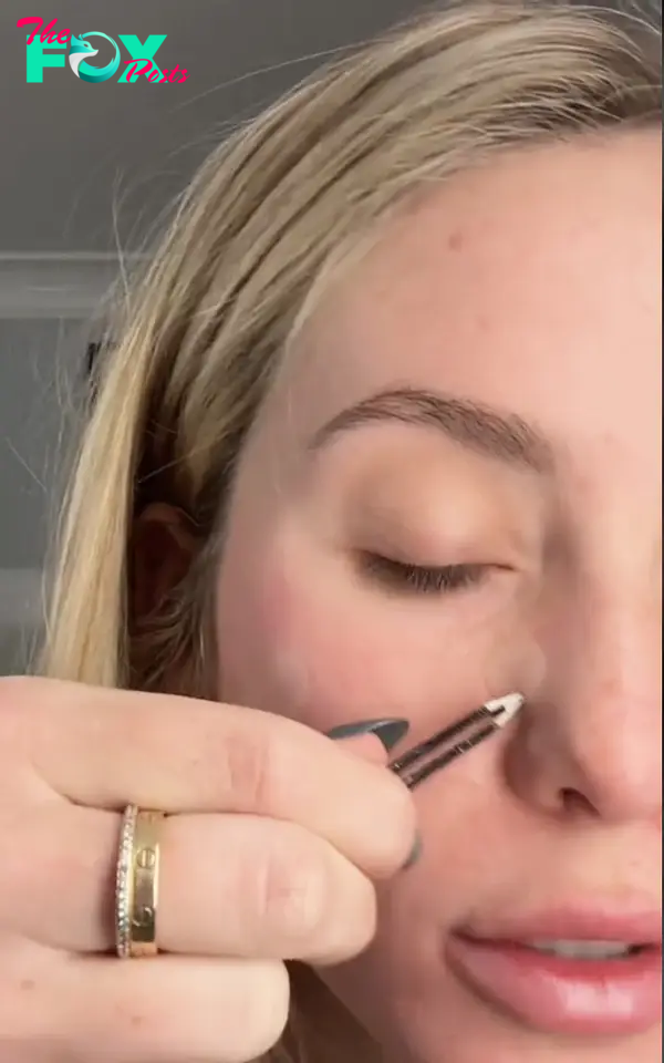 Alix Earle applying a pimple patch