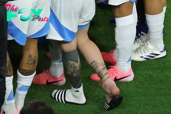 Lionel Messi ankle was visibly swollen after he trudged from the field in Miami last Sunday.
