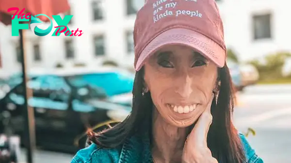 Lizzie Velásquez