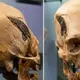 2,000-Year-Old Skull Shows Evidence of Ancient Surgery