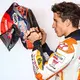 Marc Marquez admits broken right arm &quot;will never be normal&quot;