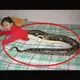 The world was confused when a rare syndrome appeared that made the lower half of the baby’s body in Thailand look like a snake (VIDEO)