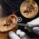 The doctor was alarmed when he found a giant python living inside the girl’s ear for a long time (VIDEO)