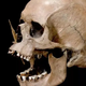 2 waves of mass murder struck prehistoric Denmark, genetic study reveals