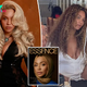 Beyoncé reveals psoriasis struggle while discussing ‘deeply personal’ hair journey