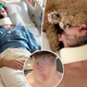 Val Chmerkovskiy shows grisly neck injury that led to hospitalization: ‘I went through some stuff’