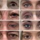 Super-realistic prosthetic eyes made in record time with 3D printing