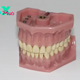 Why a Wax Try in Is Essential for Successful Dental Restorations