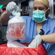 Pig kidney transplanted into human patient for 1st time ever