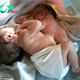 Unveiling the Extraordinary: 3.6 kg Baby Reveals Conjoined, Incompletely Developed Twin at Chest.manh