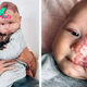 The Real Reason a Mother Decided to Get Rid of Her Son’s Birthmark with a Laser Sparks Criticism – PHOTOS