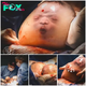 ST “Extraordinary Entrance: Exceptional Photos Document Rare 1 in 100,000 Event as Baby Is Born Encased in Intact Amniotic Sac” ST