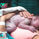 ss.Seize Incredible Moments: Preserve Your Birth Story with Gorgeous Newborn Photos