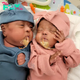 Showcase of the World’s Tiniest Twins: Weighing Less Than a Pound, Their Exceptional Resilience Leads Them to Health