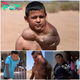 “Jose Antonio’s Brave Battle: Confronting a Giant Neck Tumor on Body Bizarre Episode” -zedd