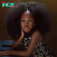 The 5-year-old girl with a special appearance was dubbed “the most beautiful black angel in the world” because of her attractive appearance.