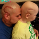 SR “The daughter, having recently undergone brain surgery, bore a lengthy scar on her scalp. In a gesture of unwavering support, her father opted to shave part of his own hair and tattoo a matching scar onto his scalp, serving as a daily reminder of encouragement for her.” SR