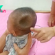 Abnormal appearance of a 4-month-old baby: Apple-shaped concave head phenomenon due to mother’s carelessness