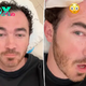 Kevin Jonas undergoes surgery to remove skin cancer: ‘Reminder to get your moles checked’