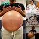 Brave Young Mother Shares Postpartum Belly Photo, Celebrating the True Beauty of Motherhood -zedd