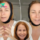 Jill Zarin reveals full ‘facial rejuvenation’ — here’s everything she had done
