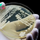 New fungal infection discovered in China
