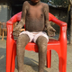 QT The Agony Of The 12-Year-Old Boy Whose Body Keeps Burning Like fire And Turns Into Stone
