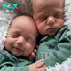 The 7-month-old inseparable twins protested being separated and insisted on sleeping together, making everyone feel extremely adorable.