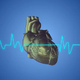 Understanding 4 of the Most Common Complications of Hypertrophic Cardiomyopathy