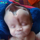 A baby born with a skull that looks like a ‘death pit’ has raised concerns and questions among medical experts.