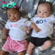 This mother is amazed by the differing skin tones of her twins and wonders what caused it…