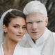 “A future supermodel!” The most handsome albino singer showed his heritage and blew up the network