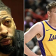 Anthony Davis Reveals Why Lakers Players Get Mad At Dalton Knecht