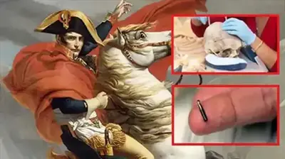 The Mysterious “Alien” Microchip Found In The Skull Of Napoleon Bonaparte