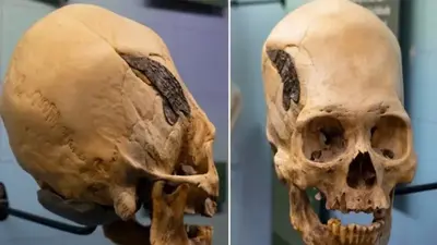 2,000-Year-Old Skull Shows Evidence of Ancient Surgery