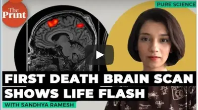 Brain Scan Performed On Person While They Died, Capturing Brain Activity That Occurred